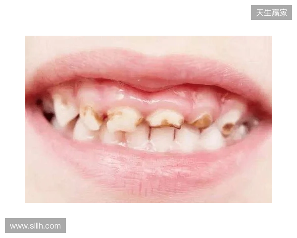 韦林顿确诊上唇部贯通伤；11、21牙半脱位；上颌前牙区牙槽骨骨折